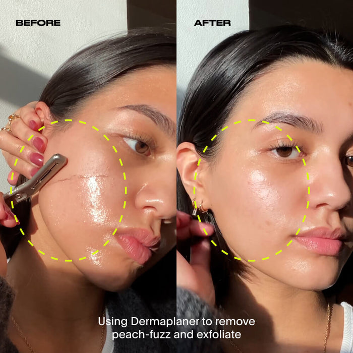 Leaf Dermaplaner Kit – alternate view 8